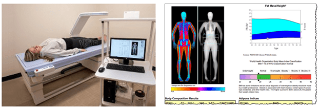 Side by side images of a person using the DEXA Body Scan machine and a  DEXA Body Scan report